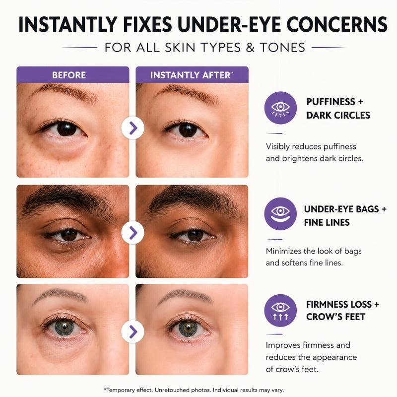 Instant Eye Tightener Easy-Wear Technology