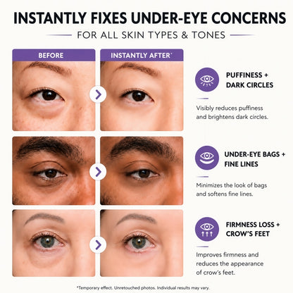 Instant Eye Tightener Easy-Wear Technology