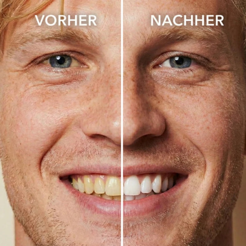 Tooth Polish - Instant Clean Smile