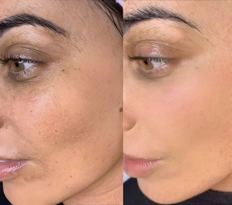 Lightweight, Natural Coverage That Works With My Olive Skin