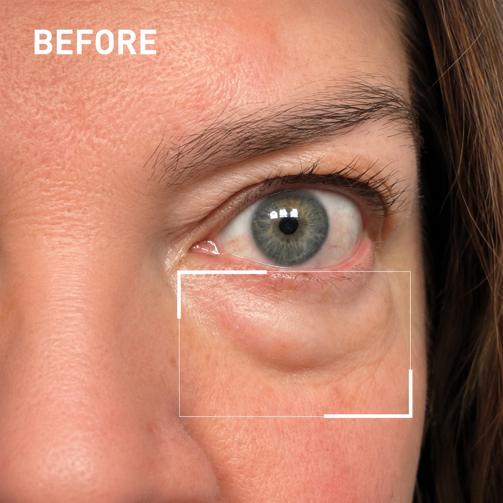 Before using the eye mask