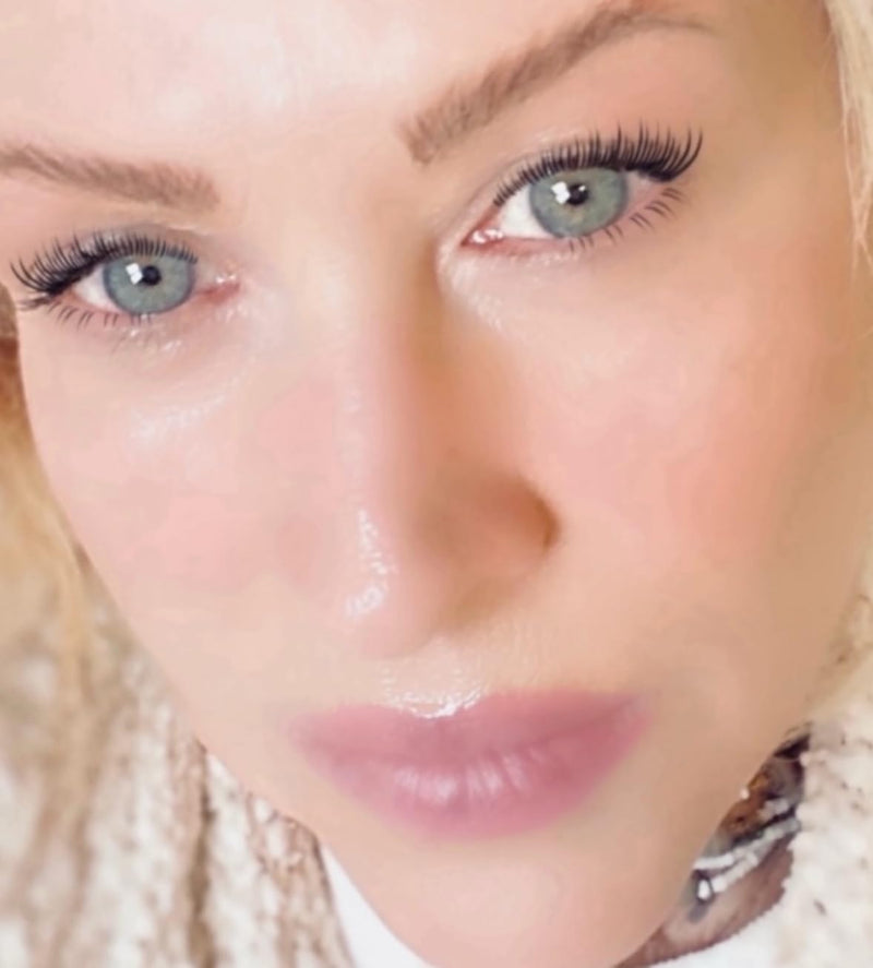 Plumps under eyes