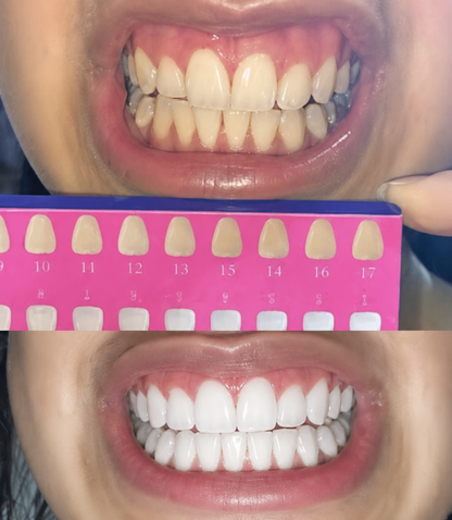 Tooth Polish - Instant Clean Smile